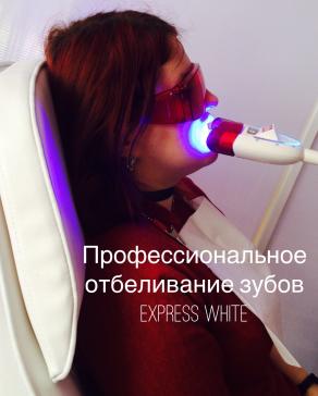 Профессиональное отбеливание зубов Express White